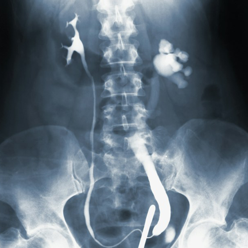Chiro-Guys-Chiropractic-Medical-Imaging-Services-Richmond-Midlothian-Staples-Mill-VA