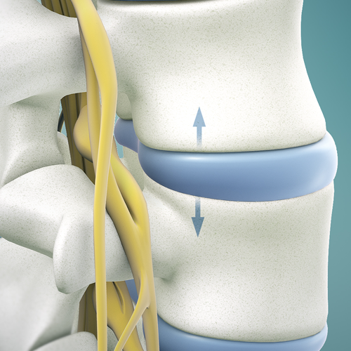 Chiro-Guys-Chiropractic-Spinal-Decompression-Services-RVA