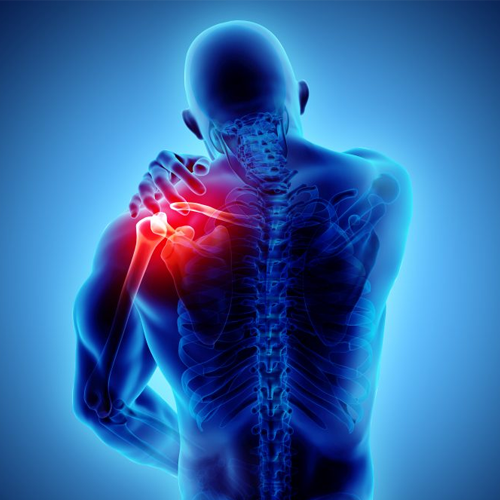 Rotator-Cuff-Pain-LightForce-Laser-Chiro-Guys-Chiropractic-VA