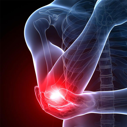 Tennis-Elbow-Golf-Pain-LightForce-Laser-Chiro-Guys-Chiropractic-VA